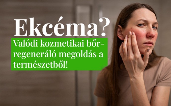 ekcéma